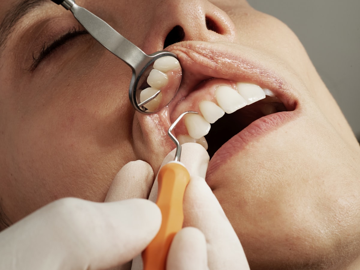 Odontólogo realizando examen dental con espejo y sonda en Medellín