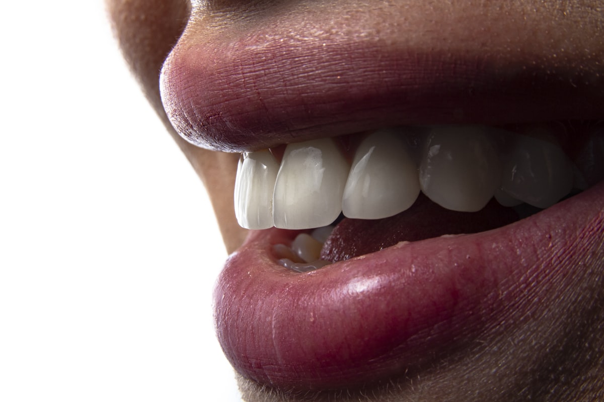 Caries dental
