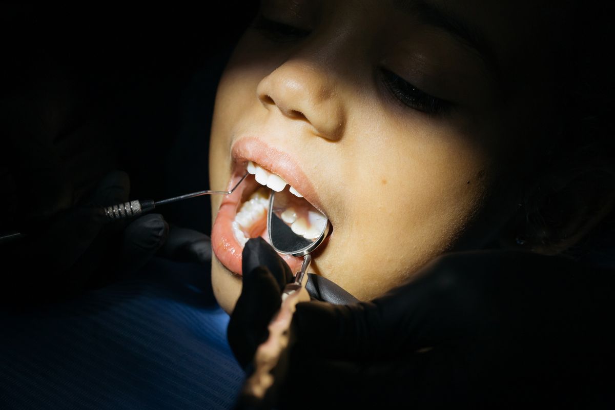 Niño en control odontológico para valorar erupción de dientes permanentes