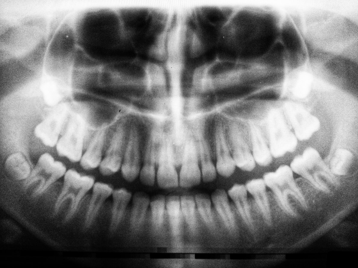 Radiografía panorámica dental mostrando la posición de las cordales