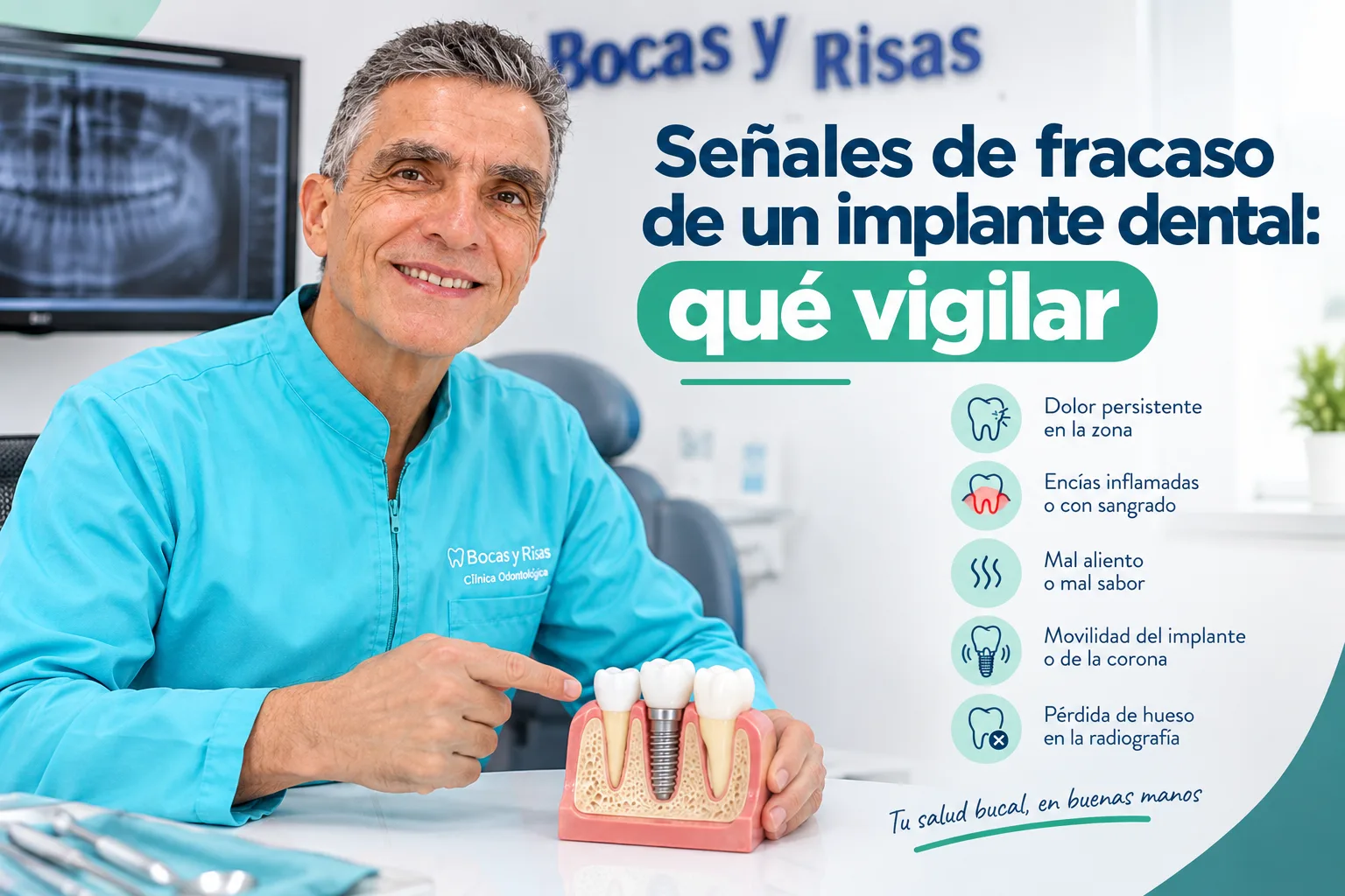 Odontólogo de Bocas y Risas señala un implante dental en modelo, con las señales de alerta: dolor persistente, encías inflamadas, mal aliento, movilidad y pérdida de hueso
