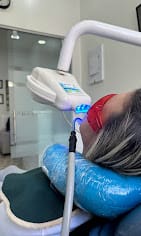 Blanqueamiento Dental