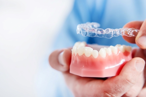 Alineadores de dientes ortodoncia invisalign