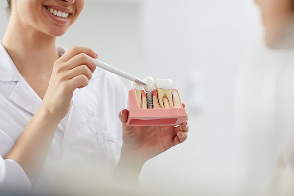 Cita de valoración para cirugía de implante dental